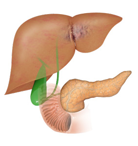 Hepatobiliary disease