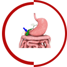 Gallbladder Disease